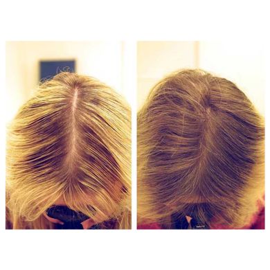 Тонік-активатор росту волосся-FEG Hair Regrowth, 60 мл, 1 шт